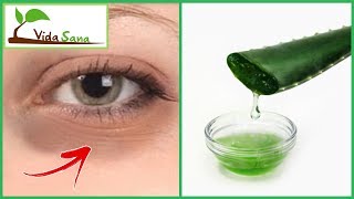 5 Tips Caseros para Eliminar Las Ojeras  Vida Sana [upl. by Elayor704]