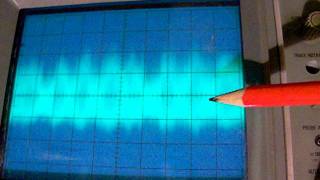 oscilloscope views inside a superheterodyne shortwave radio receiver [upl. by Anwahsal]