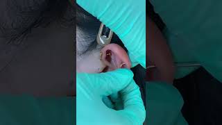 forwardhelix tragus helix earpiercing mayumipiercing [upl. by Lanor427]