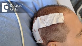 What are the risks in a Craniotomy  Dr Bopanna K M [upl. by Wattenberg]