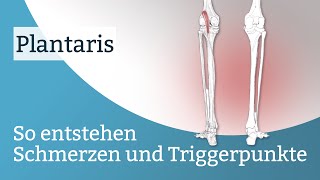 Plantaris Schmerzen Triggerpunkte und deren Aktivierung [upl. by Hars]