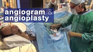 Angiogram amp angioplasty what to expect [upl. by Lehsar796]