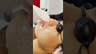 Depilación Láser Facial Sonia González Beauty Palace belleza piel paraguay [upl. by Ylrrad]