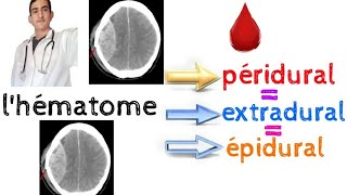 lhématome péridural extradural épidural [upl. by Aneras]