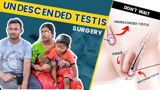 Undescended Testis  Hernia  Hypospadias Repair  Dr Nagwani  Kolkata [upl. by Colvert]