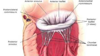 Systolic Anterior Motion Of The Mitral Valve Chordae With Dr David Adams [upl. by Nauqan]