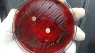 Anaerobic bacteria isolation in Microbiology  Clostridium [upl. by Anahsed]