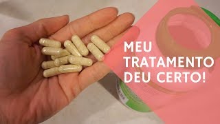 Como ACABEI com a minha Sindrome do Intestino Irritavel  Tratamento NATURAL [upl. by Ayr]