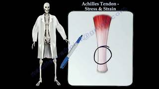 Achilles Tendon rupture Achilles tendon stress amp Strain Thompson test [upl. by Otrebcire296]