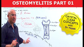 Osteomyelitis  Symptoms amp Causes🩺 [upl. by Asilej]