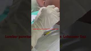 Lumbar Puncture procedure by Dr Lokeswar Das paediatricssurgeon doctor lumbarspine [upl. by Sam925]