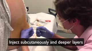 How to perform a lumbar puncture Lumbar puncture in the emergency department setting [upl. by Kalindi163]