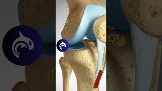 ACL Repair  Patellar Harvest  3D Animation knee kneepain kneerehab [upl. by Dareece274]