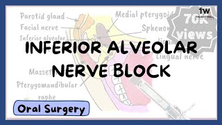 Inferior Alveolar Nerve Block Technique [upl. by Naujud]