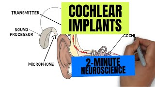 2Minute Neuroscience Cochlear Implants [upl. by Eimat699]