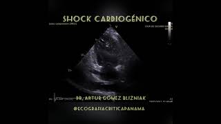 Shock cardiogénico  Miocardiopatia del paciente séptico [upl. by Swen258]