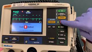 Cardioversion for atrial fibrillation [upl. by Anavas]