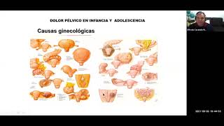 Módulo 7  Ginecología Infanto Juvenil  Clase Viernes [upl. by Arit]