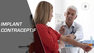 Implant contraceptif  avantages et inconvénients  Gynécologie [upl. by Gebler871]