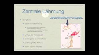 Basiskurs Neurologie Lähmungen Teil 214 [upl. by Evanne789]