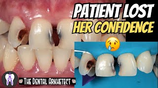 Amazing Restoration of the Patients Confidence C75 4K dental oralhealth dentalcare [upl. by Darum416]