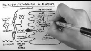 Bilirubin 2  Bilirubin Metabolism amp Diseases [upl. by Atimad992]