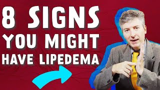 Learn About the 8 Signs That Indicate Lipedema Health of Your Legs [upl. by Cinomod]