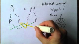 Genetics 5 Autosomal dominant disorders [upl. by Ahsiym]