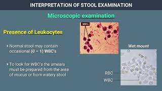 Interpretation of Stool Examination [upl. by Zarger]