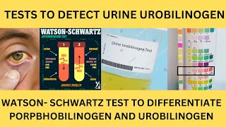 TESTS TO DETECT UROBILINOGEN IN THE URINE EhrlichsTEST PORPHOBILINOGEN TESTWatsonSchwartz Test [upl. by Windy]