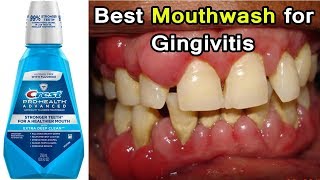 Top 3 Best Mouthwashes for Gingivitis Disease  Periodontal Disease [upl. by Myrta602]