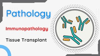 Pathology  Immunopathology  Tissue Transplantation [upl. by Lombardy]