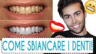 DENTI BIANCHISSIMI Ecco come faccio  GIANMARCO ZAGATO [upl. by Rokach288]