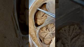 Incredible Tissue Surrounding Your Brain  Institute of Human Anatomy [upl. by Vasilis105]