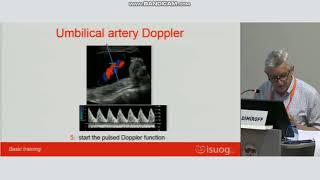 ISUOG Umbilical artery doppler [upl. by Dowling]