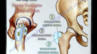 Bursitis Around The Hip  Everything You Need To Know  Dr Nabil Ebraheim [upl. by Eelrahs]