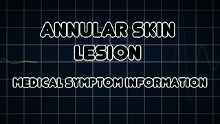 Annular skin lesion Medical Symptom [upl. by Eiloj240]