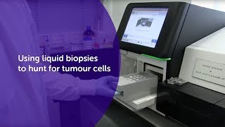 Using liquid biopsies to hunt for tumour cells  Cancer Research UK [upl. by Nylarat]