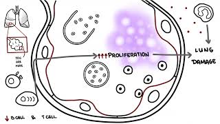 Pneumocystis jirovecii  Pneumocystis pneumonia [upl. by Efthim902]