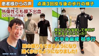 【再生医療＋リハビリ】右半身麻痺、杖歩行30代男性の点滴3回投与後の歩行の様子 [upl. by Emily]