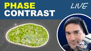 What is phase contrast microscopy [upl. by Bevin83]