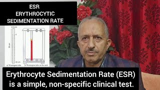 ESR Erythrocytic Sedimentation Rate [upl. by Arba]