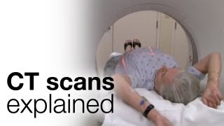 How to prepare for a CT scan [upl. by Ilak]