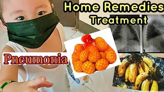 PNEUMONIA  My Home Remedies and Treatment for My Child [upl. by Aerua]