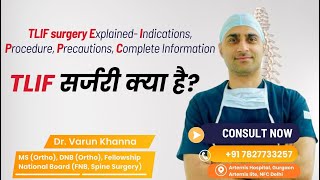 What is spinal fusion TLIF surgery क्या होता है स्पाइन फ्यूजन  spine backpain tlifsurgery [upl. by Nivloc]