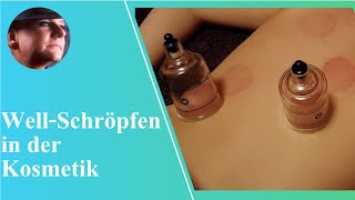 WellnessSchröpfen in der Kosmetik  schröpfen cupping massage moorpackung [upl. by Eelam592]