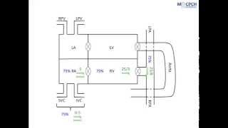 Interpreting Cardiac Catheterisation Data [upl. by Zurciram]