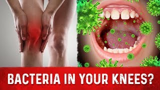 Knee Arthritis amp Your Mouth Bacteria – Arthritis Knee Pain Relief – DrBerg [upl. by Kampmann45]