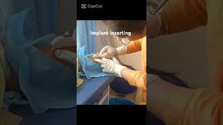 Implant inserting9995 effectiveMedical With Sanju [upl. by Dranel]