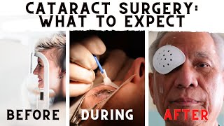 Advances in Cataract Surgery  Yale Medicine Explains [upl. by George]